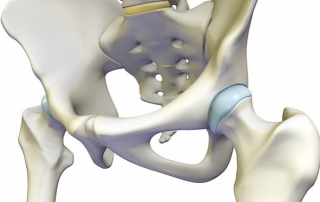 anatomic-hip