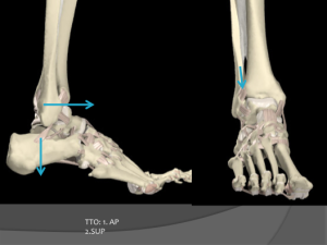 Esguince-de-Tobillo_y_Terapia-Manual-Ortopedica2