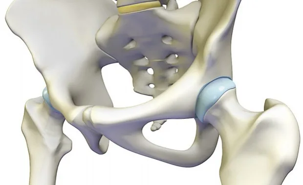 Pinzamiento de cadera , una patologia frecuente!