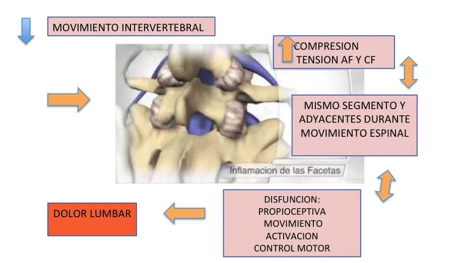 Liliana Rozo - Articulo -DolorLumbarOrigenArticular