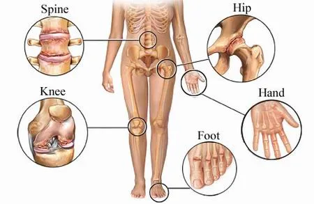 Manipulación / Terapia Manual en el Tratamiento de la OsteoArtritis